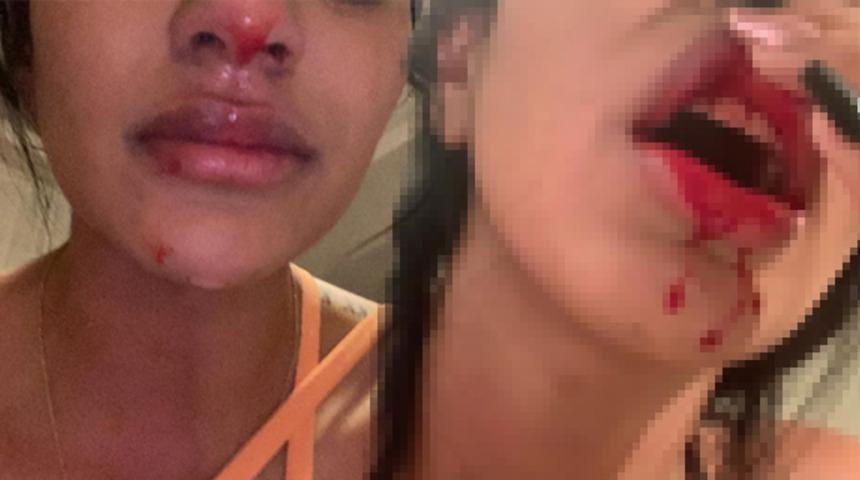 Sebastian Villa'nın kız arkadaşı darp edildiği görüntüleri ifşa etti