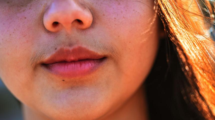 Tüylenme sorununu hafife almayın tümör riski var!