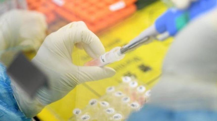 Covid-19 tanı laboratuvarı olan iller arasında Erzincan’da yer aldı