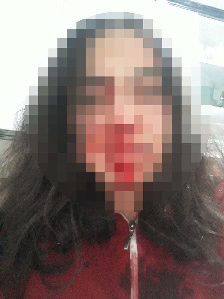 Ağabeyinin, annesini ve kendisini darbettiği söyleyen genç kız: Bizi öldürecek G2