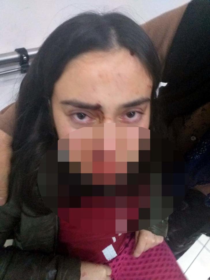 Ağabeyinin, annesini ve kendisini darbettiği söyleyen genç kız: Bizi öldürecek G3