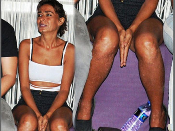 Yıldız Tilbe'nin görüntüsü üzdü G1