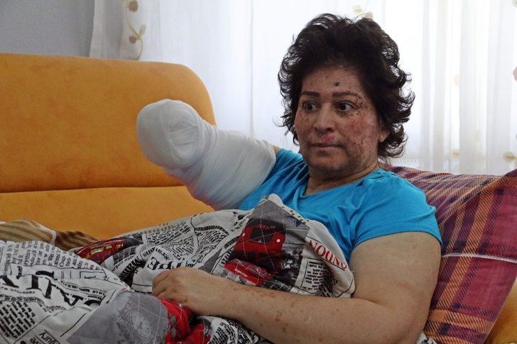 Korona değil güneş eve hapsetti! Organlarını tek tek kaybediyor G2