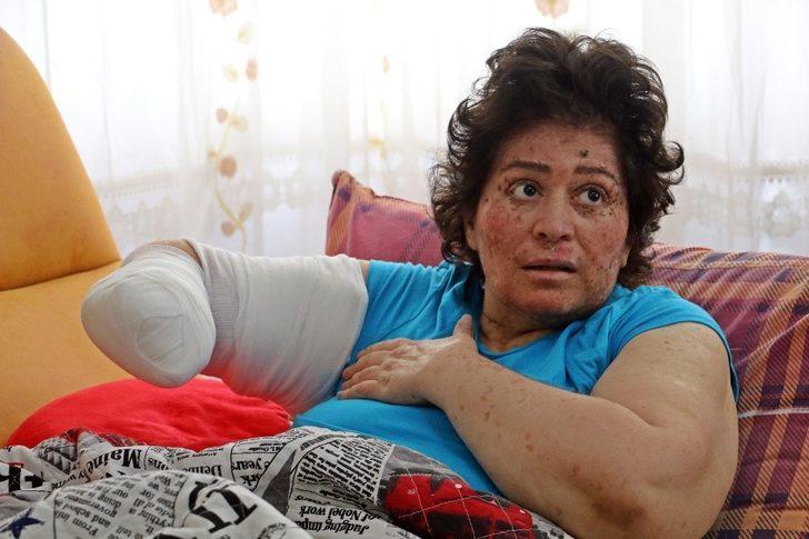 Korona değil güneş eve hapsetti! Organlarını tek tek kaybediyor G5