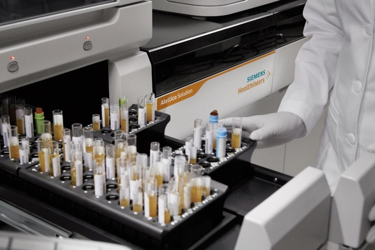 Koronavir&uuml;se karşı bağışıklık &ouml;l&ccedil;en test geliştirildi