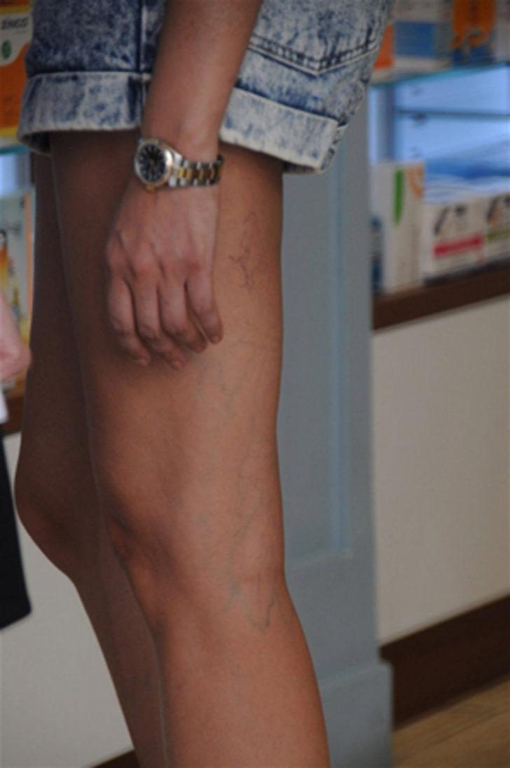 Ahu Yağtu'nun bacakları şok etti G5