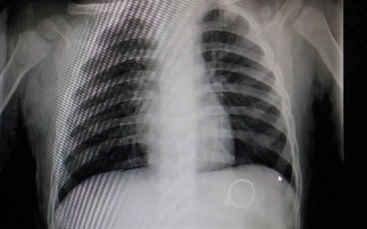 1,5 yaşındaki bebek annesinin 3 bin liralık yüzüğünü yuttu! G1