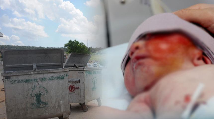 Gaziantep'te çöp konteynerinde bir günlük bebek bulundu