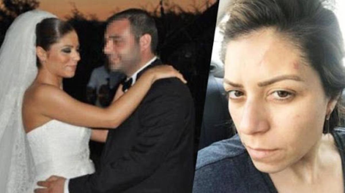 Boşandığı eşinden şiddet g&ouml;ren avukat, yaşadığı dehşeti anlattı!