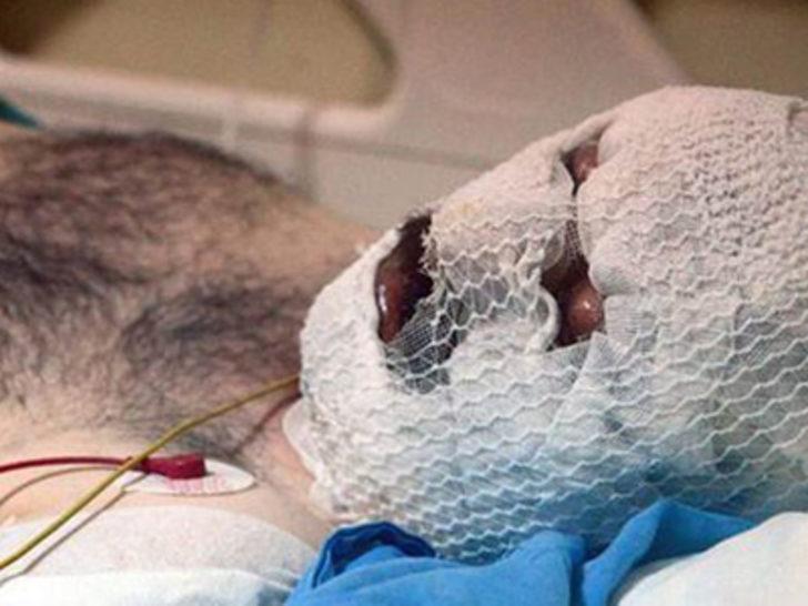 Beren Saat suskunluğunu bozdu G1