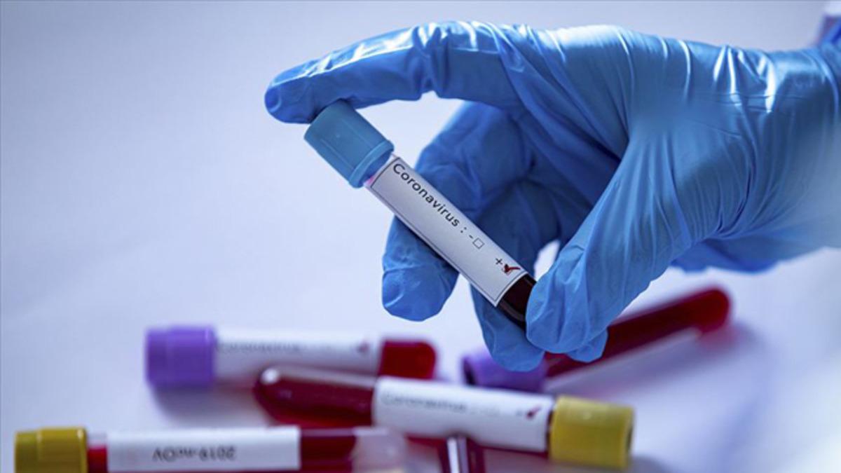 Sumo g&uuml;reş&ccedil;isi Shobushi Kanji koronavir&uuml;sten hayatını kaybetti