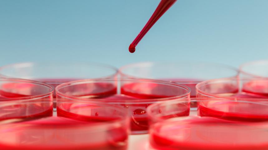 Demir eksikliği yaşamsal öneme sahip! Dünya nuüfusunun yüzde 30'u...