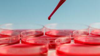 Demir eksikliği yaşamsal öneme sahip! Dünya nuüfusunun yüzde 30'u...