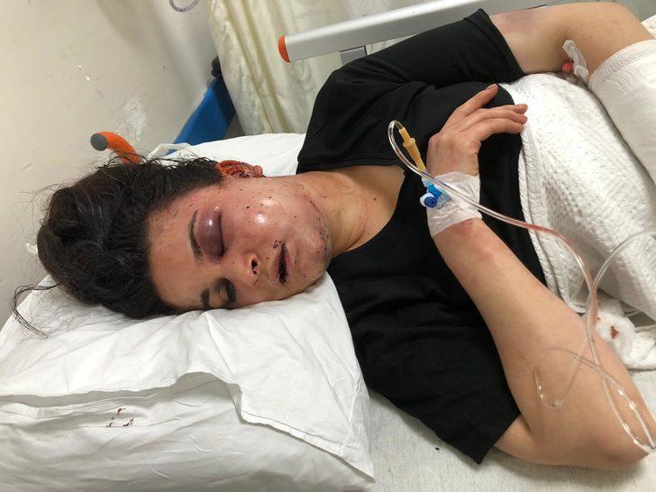 Ormana kaçırıldı, 8 saat işkence gördü! Her satırı korkunç G1