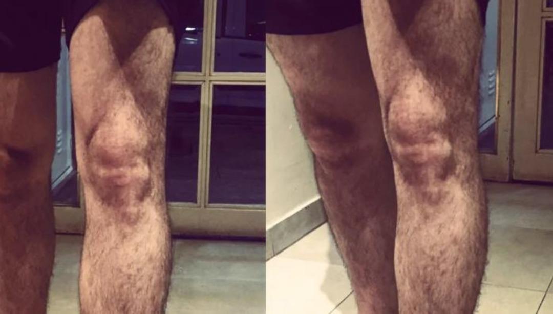 Kafaları karıştıran psikolojik fenomen: Pareidolia