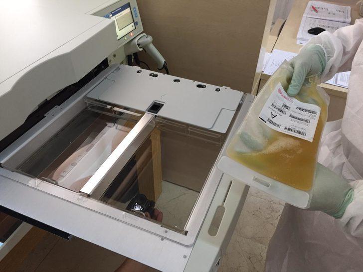 İmmün plazma tedavisinde yeni yöntem başladı G1