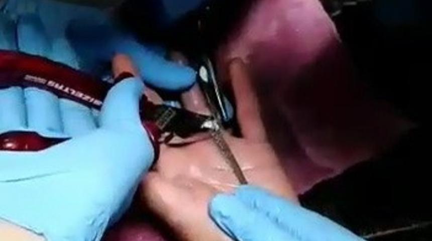 Parmağa sıkışan y&uuml;z&uuml;ğ&uuml; itfaiye &ccedil;ıkarttı