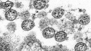 Fransa'da ilk kez bir çocuk öldü! Koronadan sonra yeni bela Kawasaki