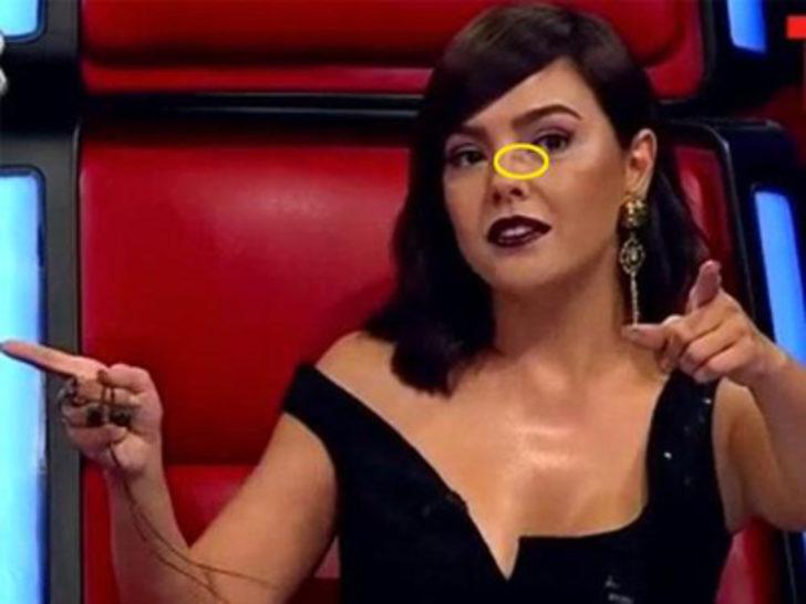 Ebru Gündeş 4 saatte eski haline döndü G2