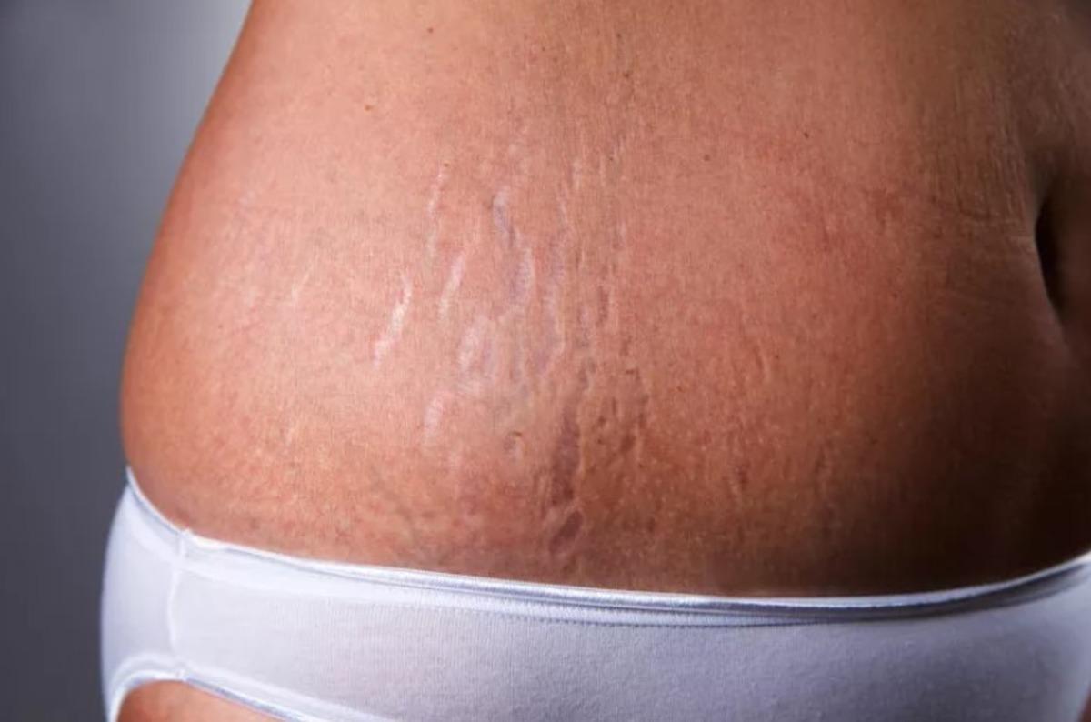 Hi&ccedil;bir yararı yok ama bu g&uuml;zellik &uuml;r&uuml;nlerini kullanmaya devam ediyoruz