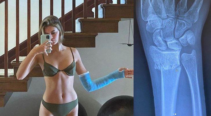 Kaia Gerber kolunu kırdı! İç çamaşırlarıyla poz verdi G2