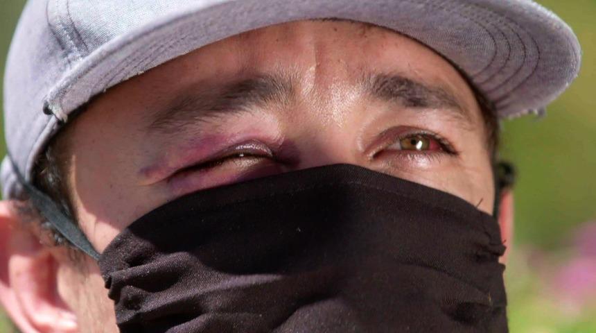 Meksika'da şiddete maruz kalan sağlık &ccedil;alışanları: 'İşimizi yapmamıza izin verin'