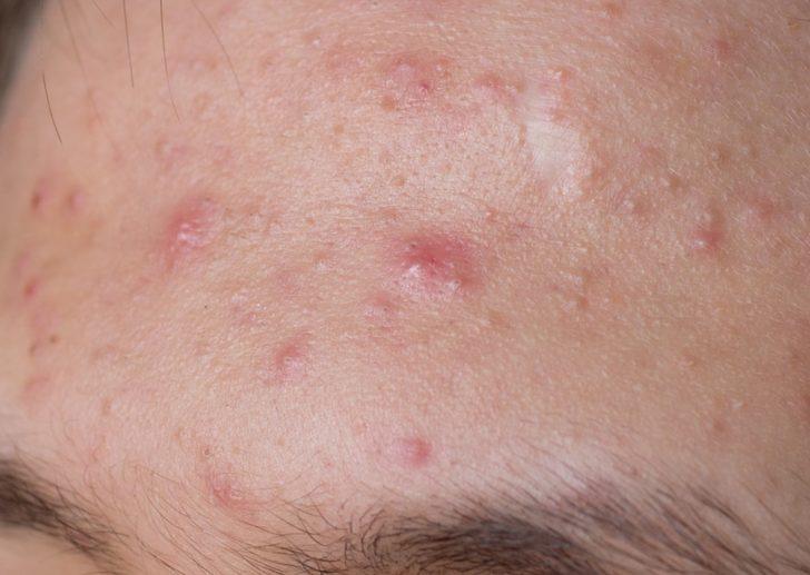 Uzmanı önermiyor! Birçoğunu kullanıyoruz ama bu ürünler kara listede G5