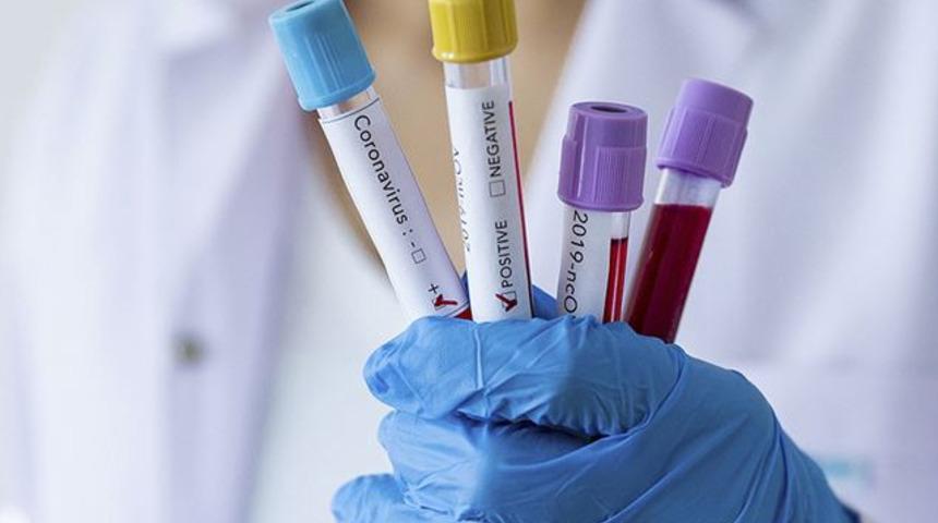 Prof. Dr. Levent Yamanel'den koronavirüs açıklaması! Haziranın ortasını işaret etti