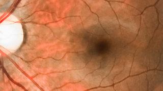 Göz Tansiyonu Rehberi: Nedir? Belirtileri Neler? Kaç Olmalı?