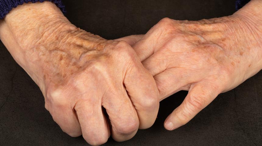 Detaylı Parkinson Hastalığı Rehberi: Nedir? Belirtileri Nelerdir?