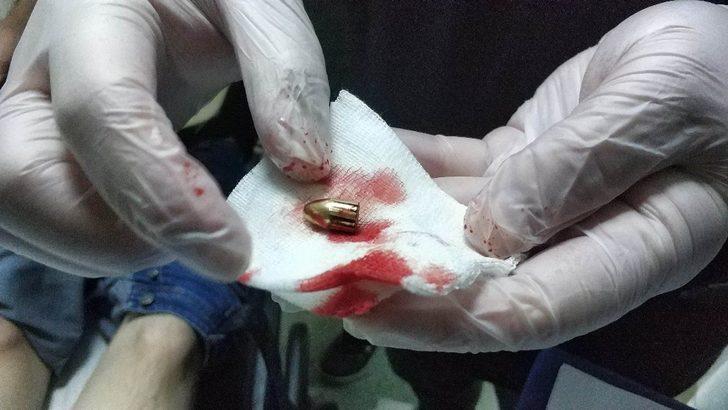 Bacağındaki acı yüzünden hastaneye gitti, vurulduğunu öğrendi G2