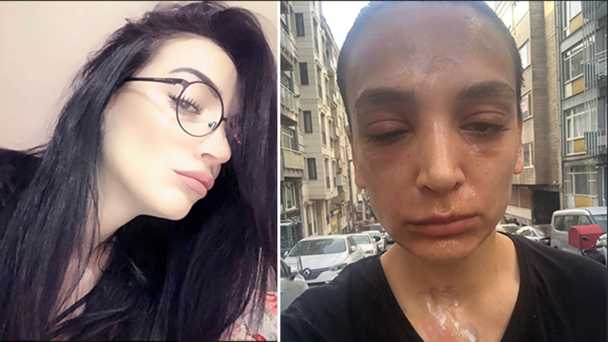 Lavabo &ccedil;&ouml;z&uuml;c&uuml; bomba gibi patladı