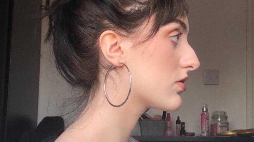 G&uuml;zellik standartlarına burnuyla meydan okudu! Destek mesajı yağdı