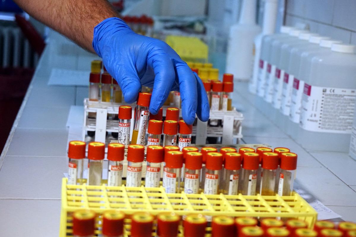 İstanbul Tıp Fak&uuml;ltesi'nde antikor testi yapılmaya başlandı! 'Yalancı negatif' sonu&ccedil;ların &ouml;n&uuml;ne ge&ccedil;ilecek