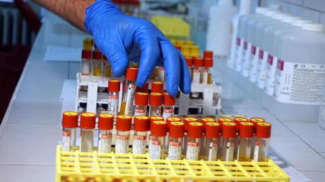 İstanbul Tıp Fakültesi'nde antikor testi yapılmaya başlandı! 'Yalancı negatif' sonuçların önüne geçilecek