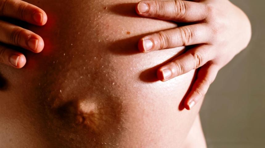 ‘Yeni normal’de hamileler ve emziren anneler dikkat!