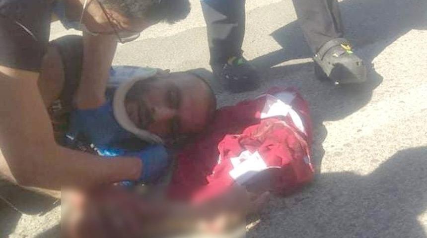 Motosiklet devrildi: 2 yaralı