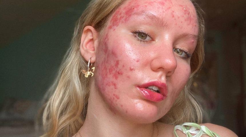 Instagram’ın ‘leke kraliçesi’nden dikkat çeken paylaşım!