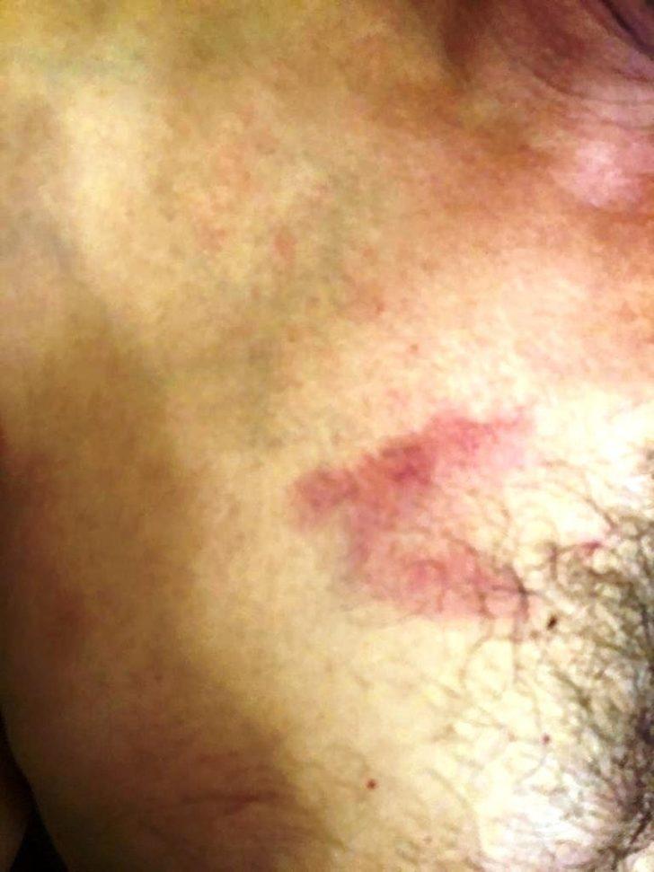 ATO Başkanı saldırı için suç duyurusunda bulundu G4