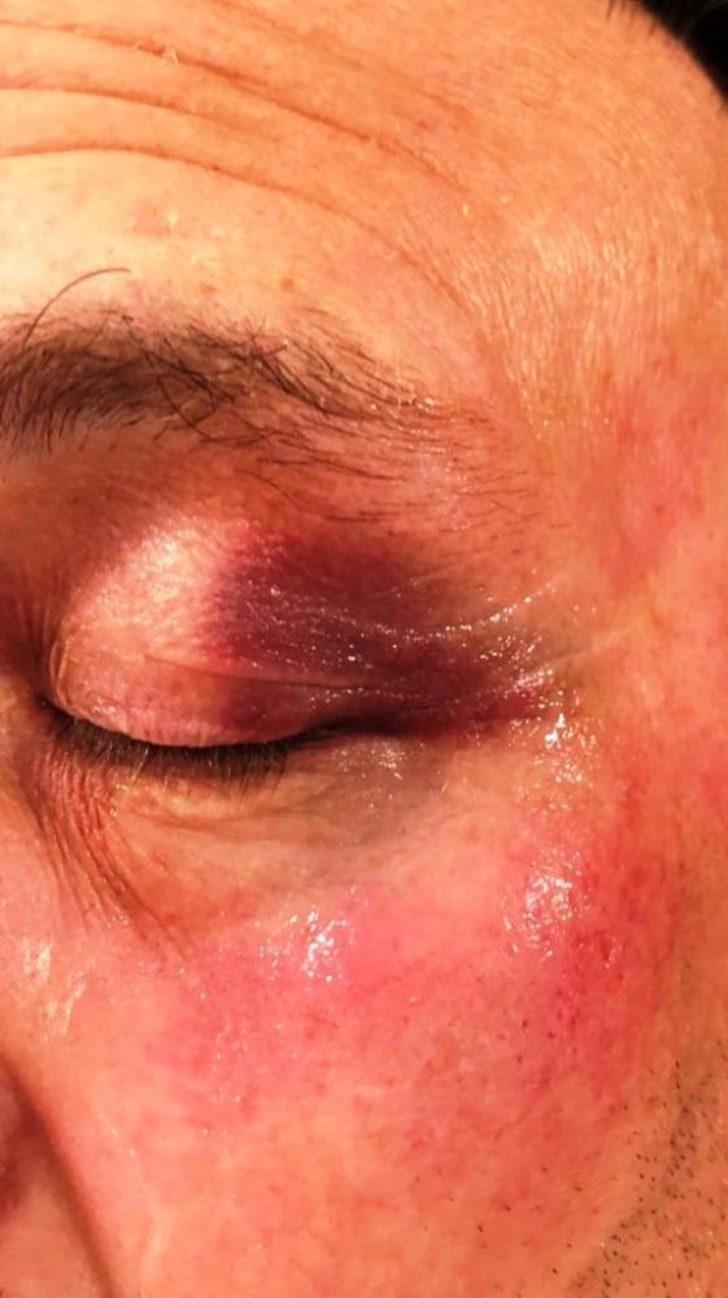 ATO Başkanı saldırı için suç duyurusunda bulundu G5