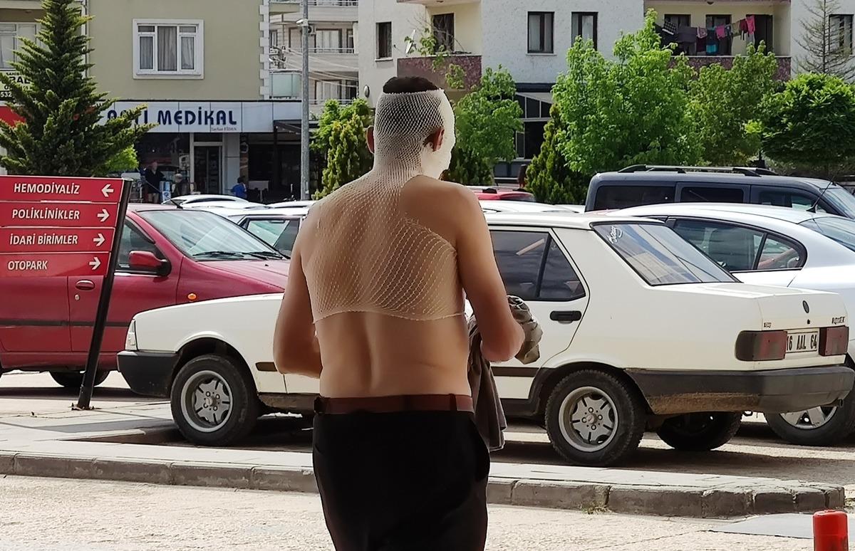 Fabrikada buhar hortumu patladı, iş&ccedil;inin y&uuml;z&uuml; ve v&uuml;cudu yandı