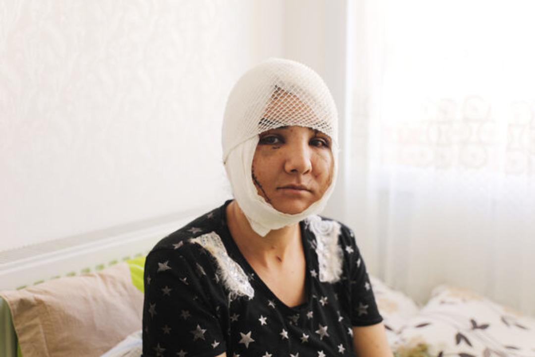 Kıskan&ccedil;lık vahşeti! Y&uuml;z&uuml;n&uuml; ve boğazını kesti, 100'den fazla dikiş atıldı