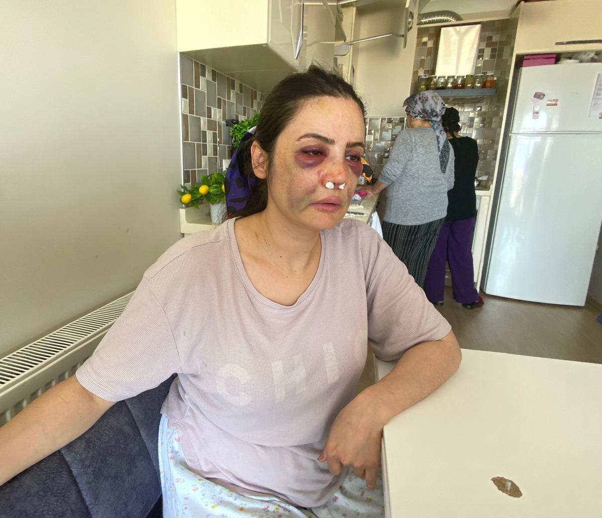 Boşanmak istediği eşi dehşeti yaşattı