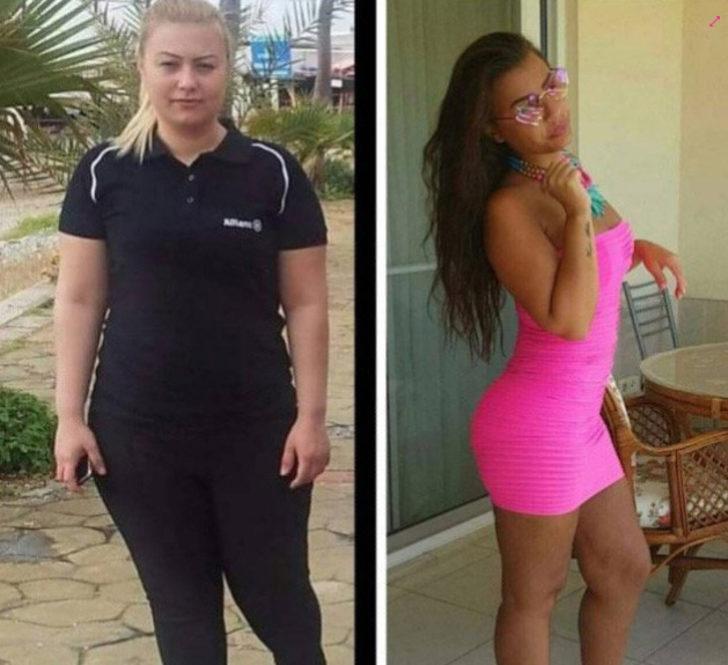 Yok böyle değişim! 22 estetik operasyon için 240 bin TL harcadı G1