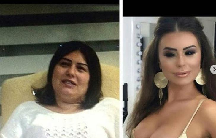 Yok böyle değişim! 22 estetik operasyon için 240 bin TL harcadı G3