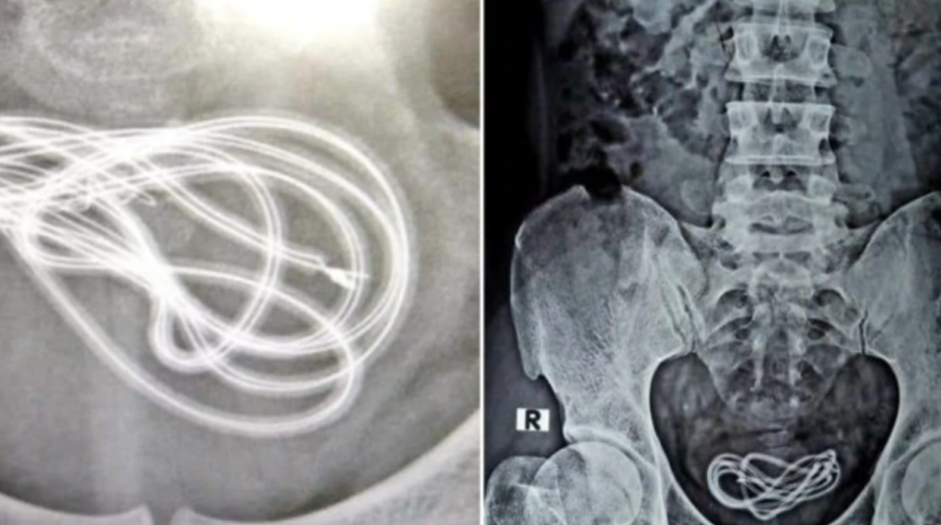 Mesanesinden 60 santimetrelik şarj kablosu çıkarıldı