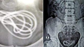 Mesanesinden 60 santimetrelik şarj kablosu çıkarıldı