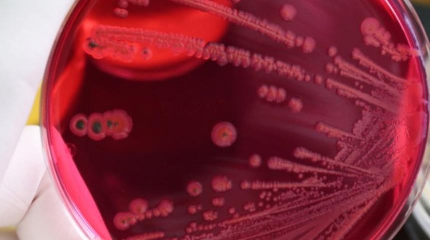 Yazın artan besin zehirlenmelerine dikkat