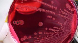 Yazın artan besin zehirlenmelerine dikkat