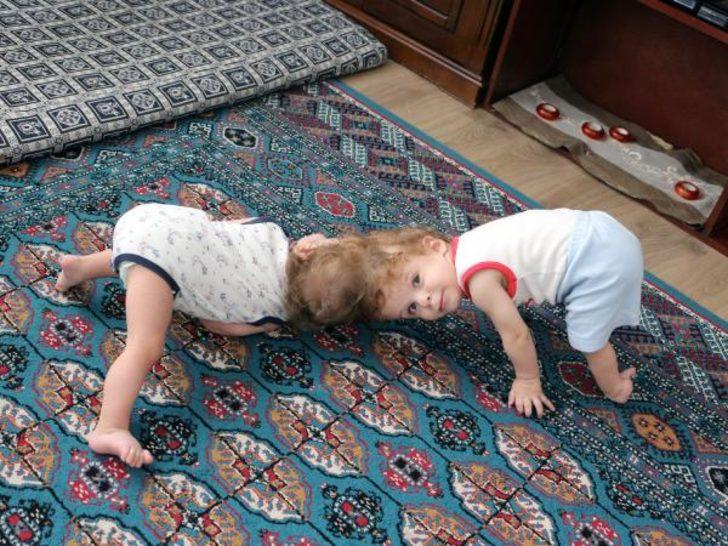 Güzel haberi Cumhurbaşkanı Erdoğan vermişti! İşte ikizlerin son halleri G4